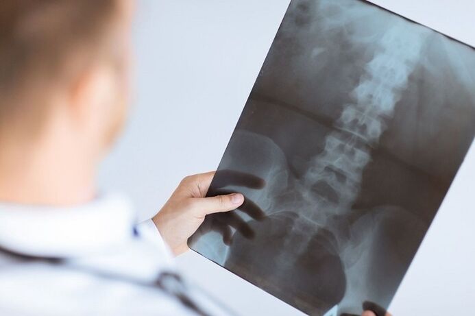 Lumbar Osteokondrosiarentzako diagnostiko aukerak