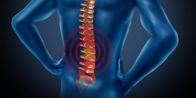 Lumbar eskualdeko osteokondrosia