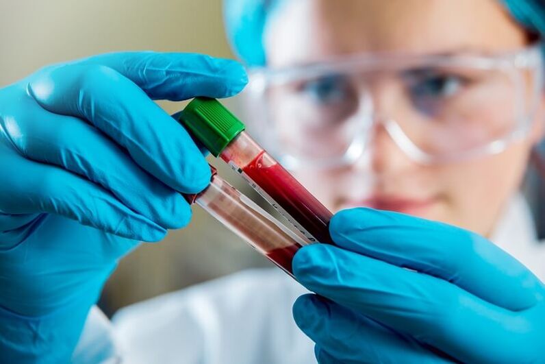 Odol azterketa osoa bizkarreko mina diagnostikatzeko